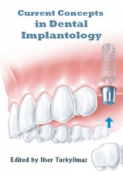 Current Concepts in Dental Implantology  (pdf)